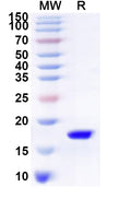 Recombinant Human SNX8 Protein, N-His