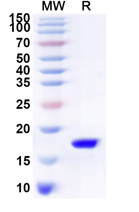 Recombinant Human SNX8 Protein, N-His