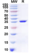 Recombinant Human NEXMIF Protein, N-His-KSI