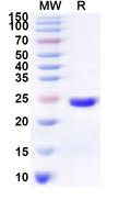 Recombinant Human MS4A2 Protein, N-His-KSI