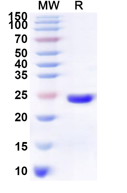 Recombinant Human MS4A2 Protein, N-His-KSI