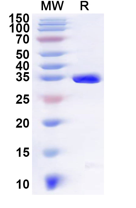 Recombinant Human UBXN2B Protein, N-GST & C-His