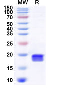 Recombinant Human RBM25 Protein, N-His