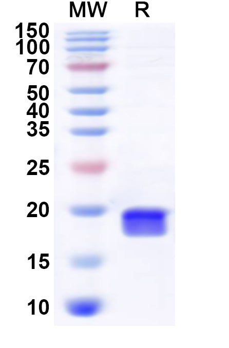 Recombinant Human RBM25 Protein, N-His