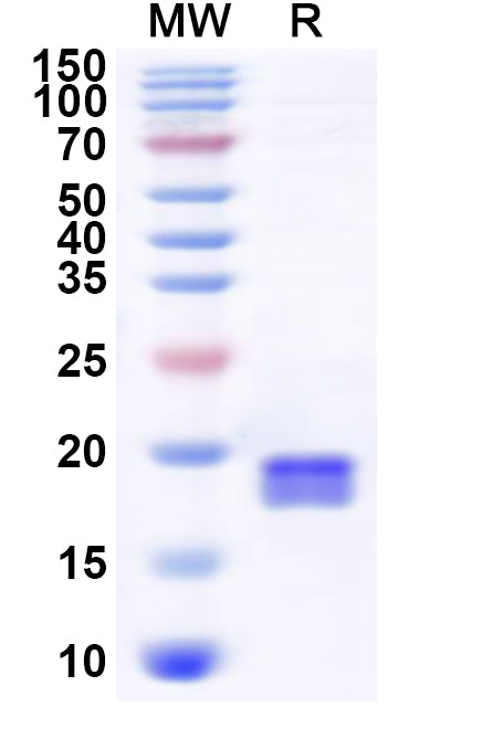 Recombinant Human UBE2A Protein, N-His