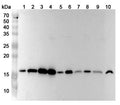 Western blot analysis was performed using anti-UBE2A polyclonal antibody at 1ug/mL on various samples.
Lane 1: Hela cell lysate
Lane 2: A549 cell lysate
Lane 3: 293T cell lysate
Lane 4: A375 cell lysate
Lane 5: SW620 cell lysate
Lane 6: Jurkat cell lysate
Lane 7: N2A cell lysate
Lane 8: NIH3T3 cell lysate
Lane 9: Mouse brain lysate
Lane 10: Rat brain lysate