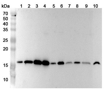 Western blot analysis was performed using anti-UBE2A polyclonal antibody at 1ug/mL on various samples.
Lane 1: Hela cell lysate
Lane 2: A549 cell lysate
Lane 3: 293T cell lysate
Lane 4: A375 cell lysate
Lane 5: SW620 cell lysate
Lane 6: Jurkat cell lysate
Lane 7: N2A cell lysate
Lane 8: NIH3T3 cell lysate
Lane 9: Mouse brain lysate
Lane 10: Rat brain lysate