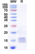 Recombinant Human DYNLT3 Protein, N-His
