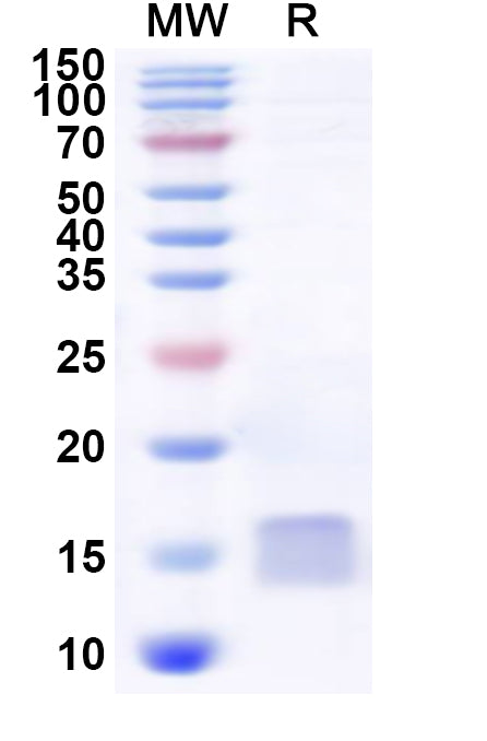 Recombinant Human DYNLT3 Protein, N-His