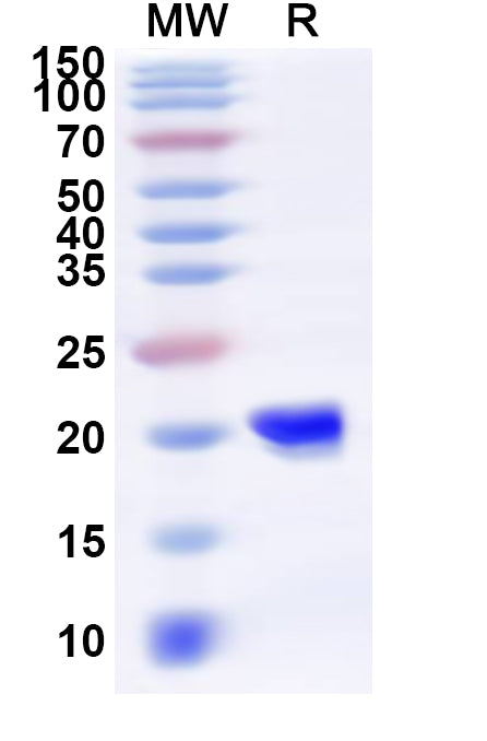 Recombinant Human FHIT Protein, N-His