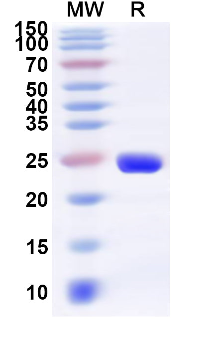Recombinant Human CHN2 Protein, N-His