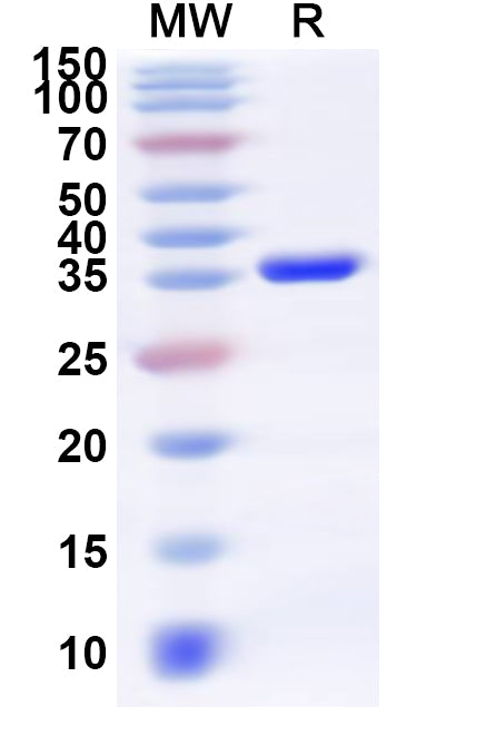Recombinant Human NAPA Protein, N-His