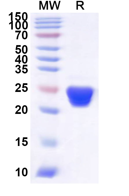 Recombinant Human GRSF1 Protein, N-His