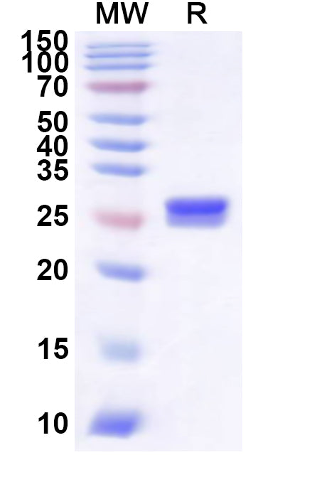 Recombinant Human STARD3 Protein, N-His