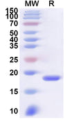 Recombinant Human MED21 Protein, N-His