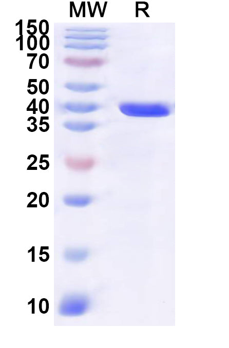 Recombinant Human RNPS1 Protein, N-GST & C-His