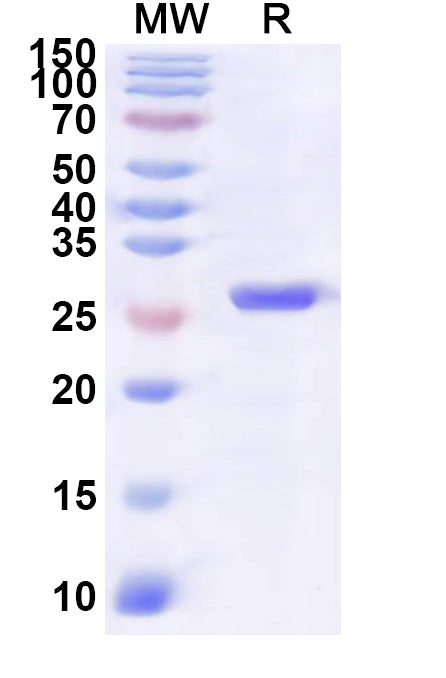 Recombinant Human KANK1 Protein, N-His