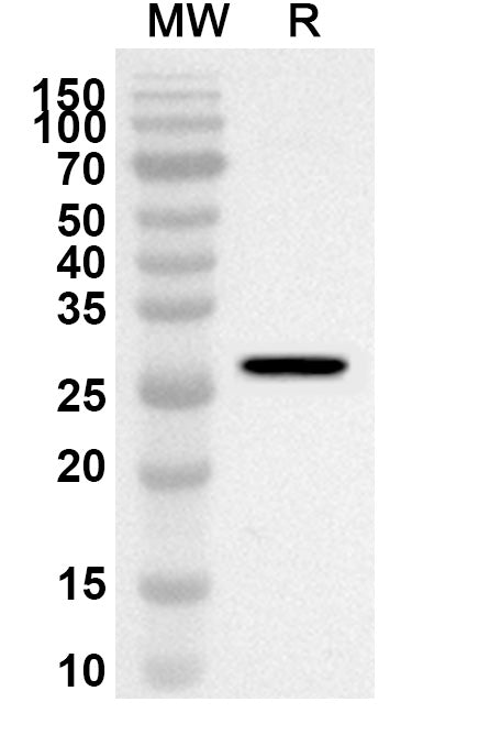 Western blot analysis was performed using anti-KANK1 polyclonal antibody at 1ug/mL on recombinant KANK1 (Catalog No. HB427012).