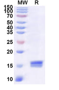 Recombinant Human RGS1 Protein, N-His