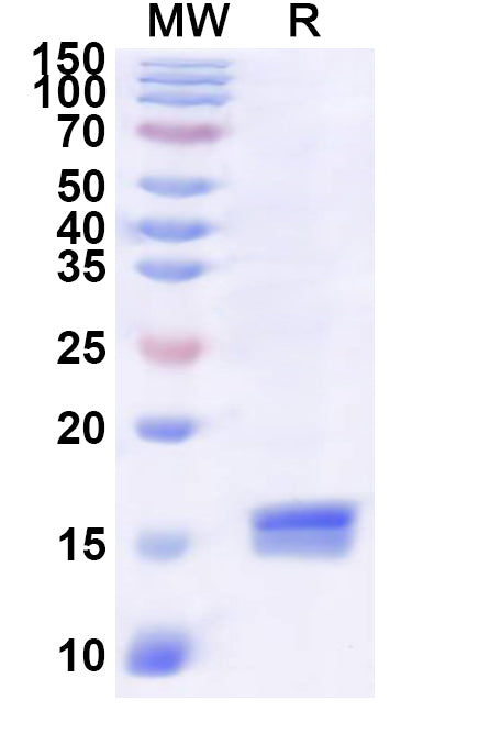 Recombinant Human RGS1 Protein, N-His