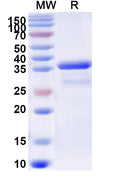 Recombinant Human CARD18 Protein, N-GST & C-His