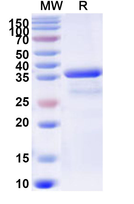Recombinant Human CARD18 Protein, N-GST & C-His