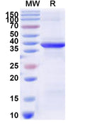 Recombinant Human RPS29 Protein, N-GST & C-His
