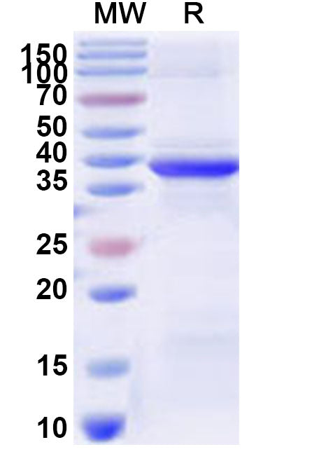 Recombinant Human RPS29 Protein, N-GST & C-His