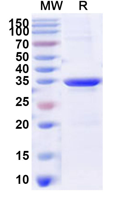 Recombinant Human RPL30 Protein, N-His