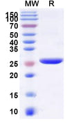 Recombinant Human NMRK1 Protein, N-His