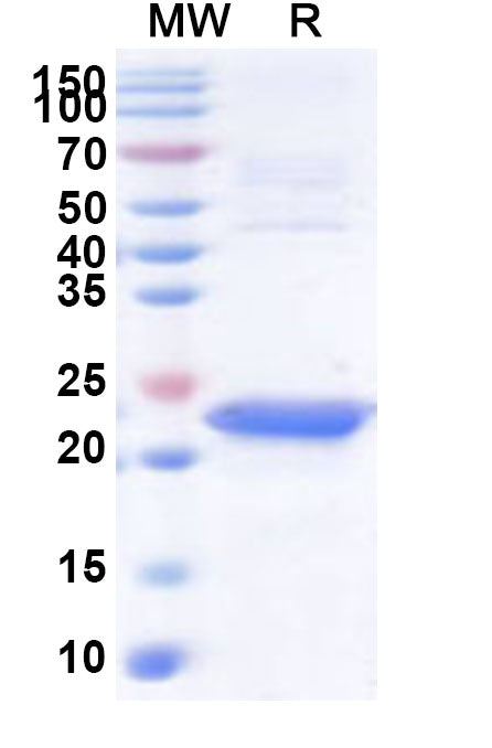 Recombinant Human CDC73 Protein, N-His