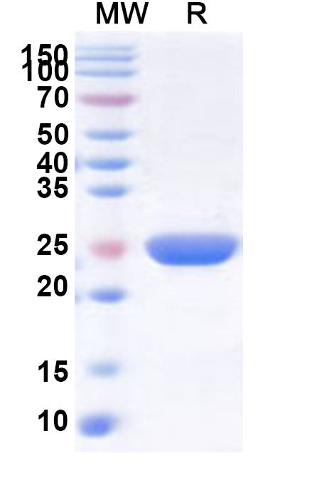 Recombinant Human SMU1 Protein, N-His