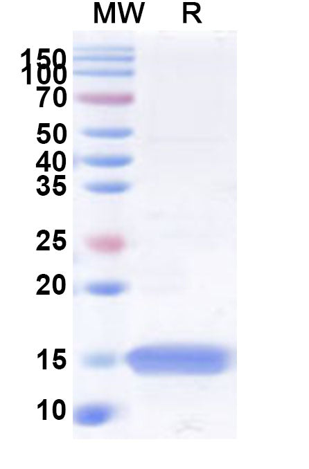 Recombinant Human CNN3 Protein, N-His