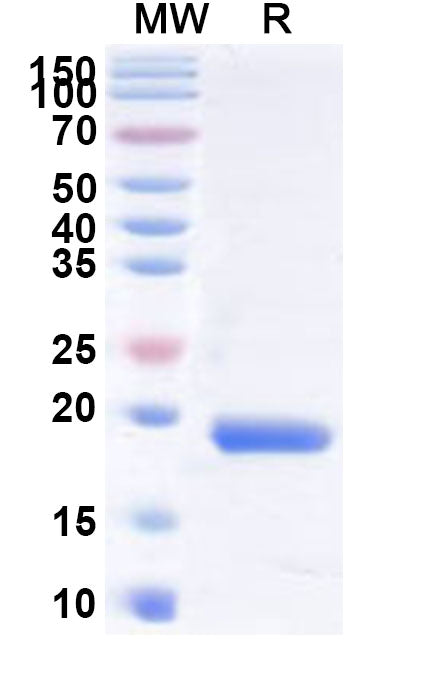 Recombinant Human TRIP4 Protein, N-His