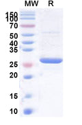 Recombinant Human TSN Protein, N-His