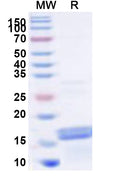 Recombinant Human FIP1L1 Protein, N-His