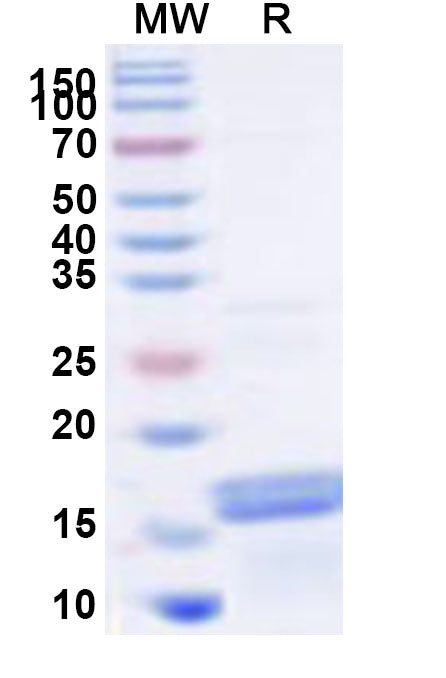 Recombinant Human FIP1L1 Protein, N-His