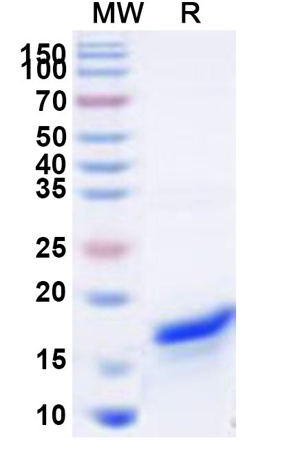 Recombinant Human SLC30A9 Protein, N-His