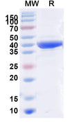 Recombinant Human ADPRS Protein, N-His