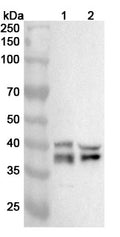 Western blot analysis was performed using anti-ADPRS polyclonal antibody at 1ug/mL on various samples.
Lane 1: Rat brain lysate
Lane 2: Rat heart lysate