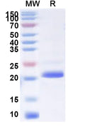 Recombinant Human POLE3 Protein, N-His