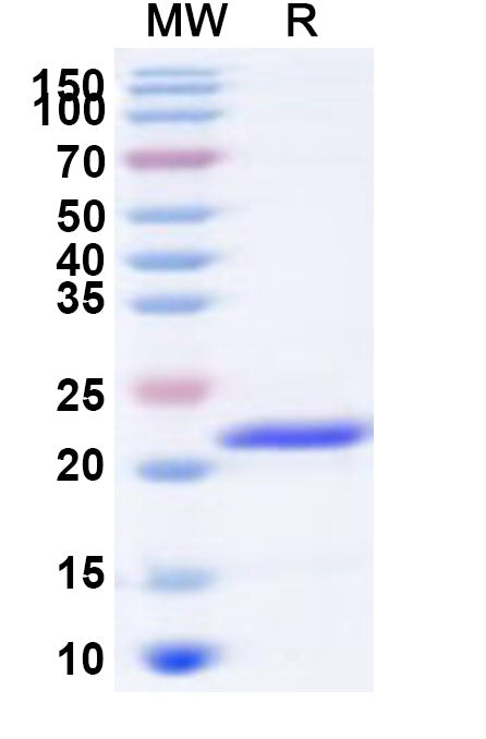 Recombinant Human GTF2H2 Protein, N-His
