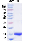 Recombinant Human SF3A1 Protein, N-His