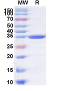 Recombinant Human BEND3 Protein, N-His