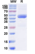 Recombinant Human DMPK Protein, N-His