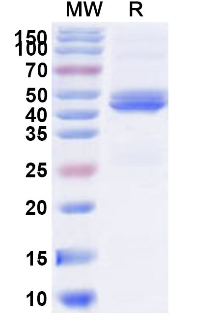 Recombinant Human DMPK Protein, N-His