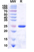 Recombinant Human CDK2AP2 Protein, N-His-KSI