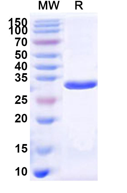 Recombinant Human H2AP Protein, N-His-KSI