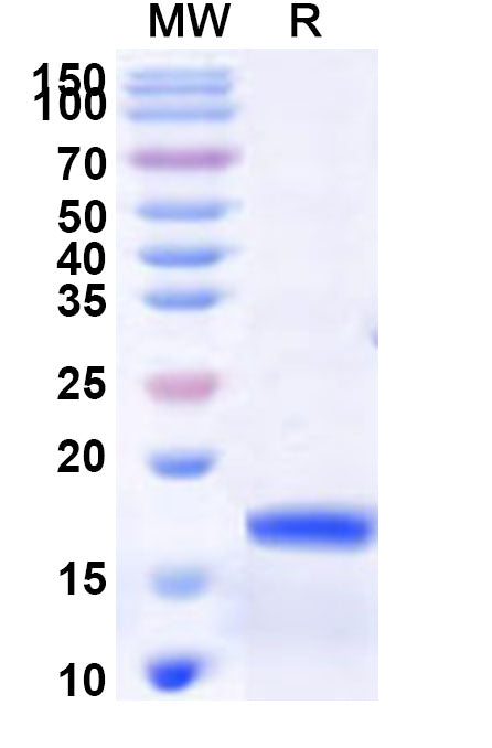 Recombinant Human PHLPP2 Protein, N-His