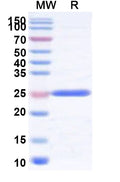 Recombinant Human SRSF5 Protein, N-His